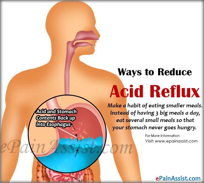 Acid Reflux