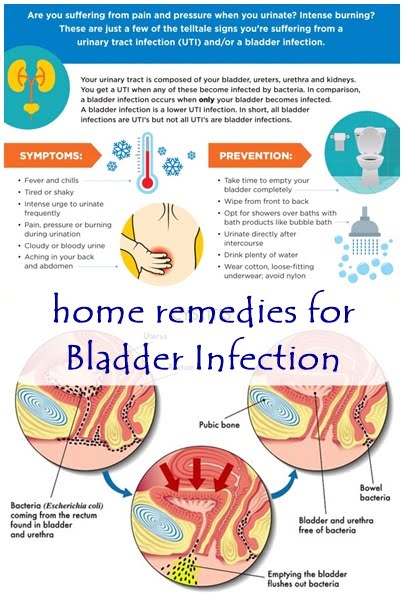 Bladder Infection (Infection Urinary)