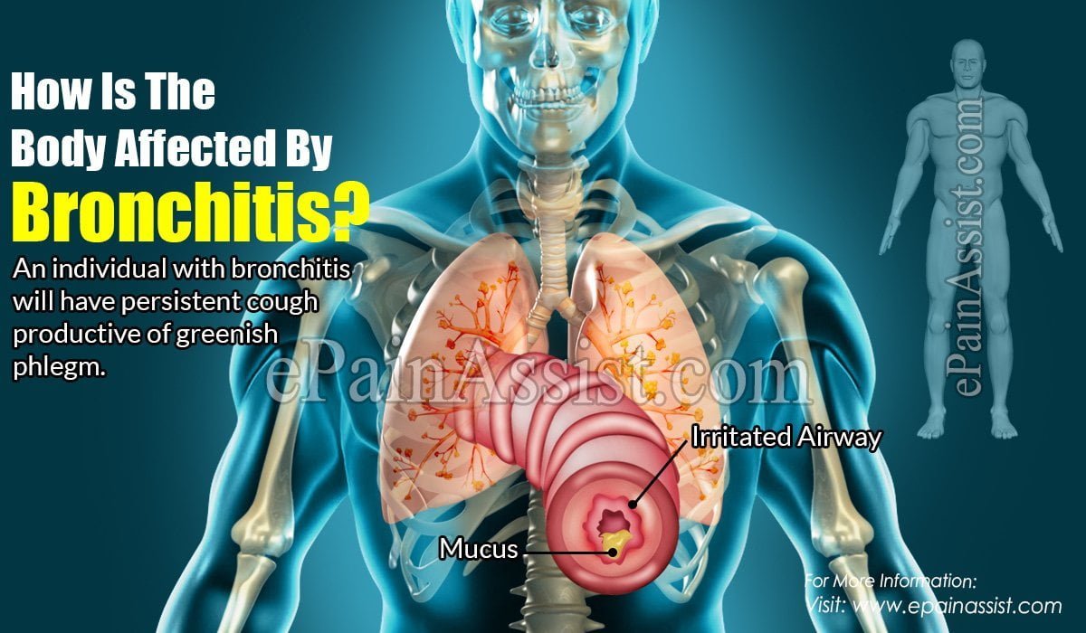 Bronchitis