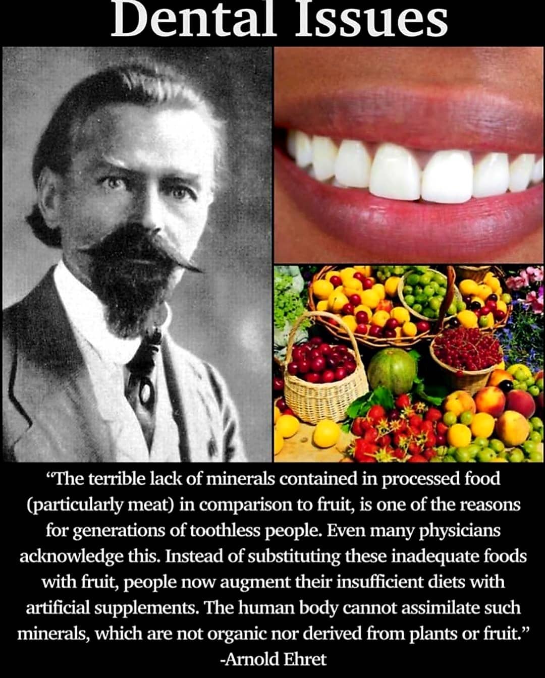 Take care of your teeth folks.  Be sure to eat plenty of fruit. 
.
.
.
.
.
.
.
….