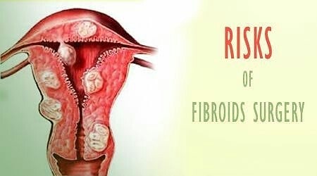 RISKS OF FIBROID SURGERY. “please I have been operated on fibroid before, and no…