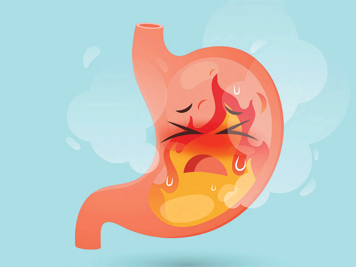 Indigestion: Natural Remedies to Help You Feel Better Fast – Best Health Magazine